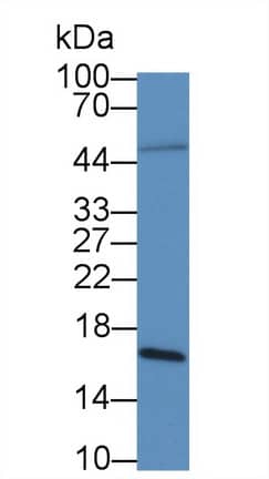 Galectin-2 Antibody (C11)
