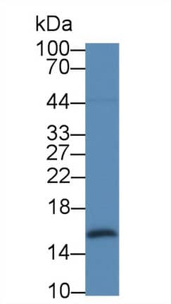 Galectin-2 Antibody (C11)