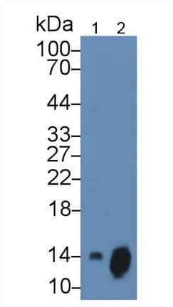 CXCL7/NAP-2 Antibody (15#)