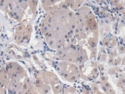 EGR1 Antibody (C11)