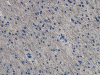 Endothelin-1 Antibody (C10)