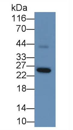 GSTA1 Antibody (4#)