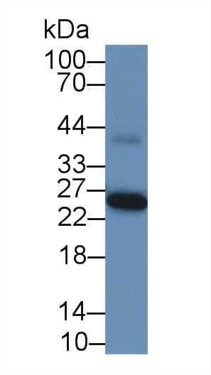 GSTA1 Antibody (4#)