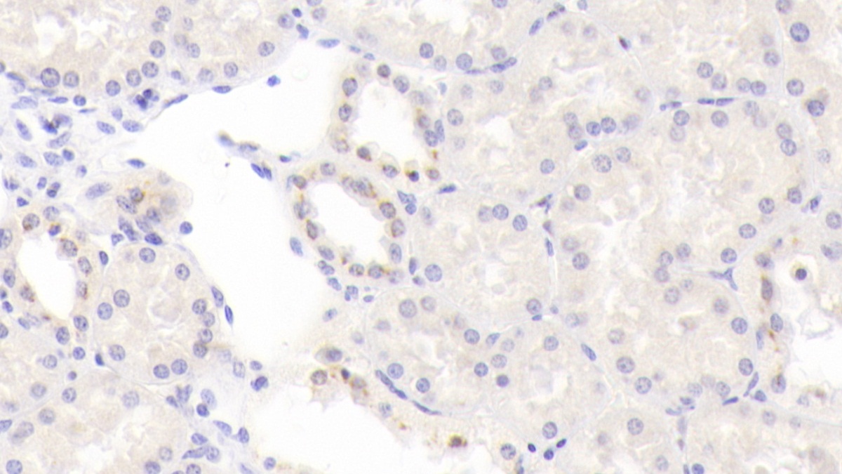 BMP-6 Antibody (D2)