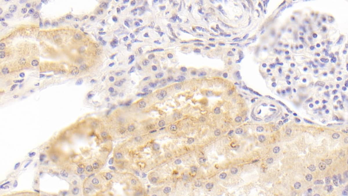 ABP1/AOC1 Antibody (C3)