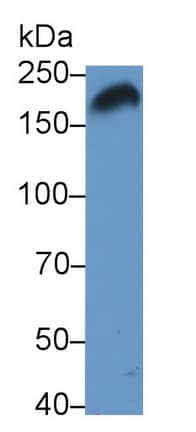 Pappalysin-1/PAPP-A Antibody (H4)