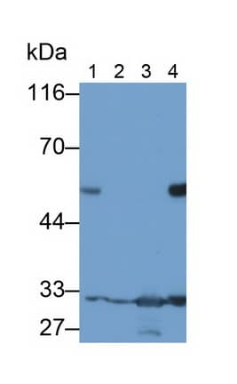 Podocin/NPHS2 Antibody (C3)