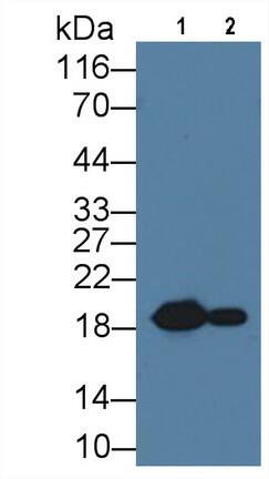 HSP20/HSPB6 Antibody (C5)
