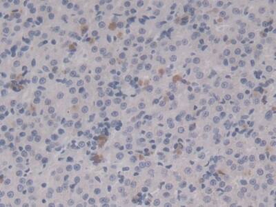 HSP20/HSPB6 Antibody (C5)