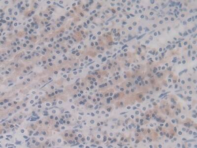 HSP20/HSPB6 Antibody (C5)