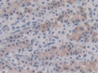 HSP20/HSPB6 Antibody (C10)