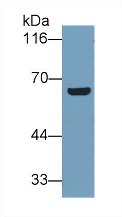 T Plastin Antibody (C11)