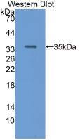 RBP3 Antibody (7#)