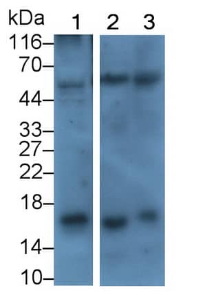 Corticotropin Releasing Factor Antibody (E1)