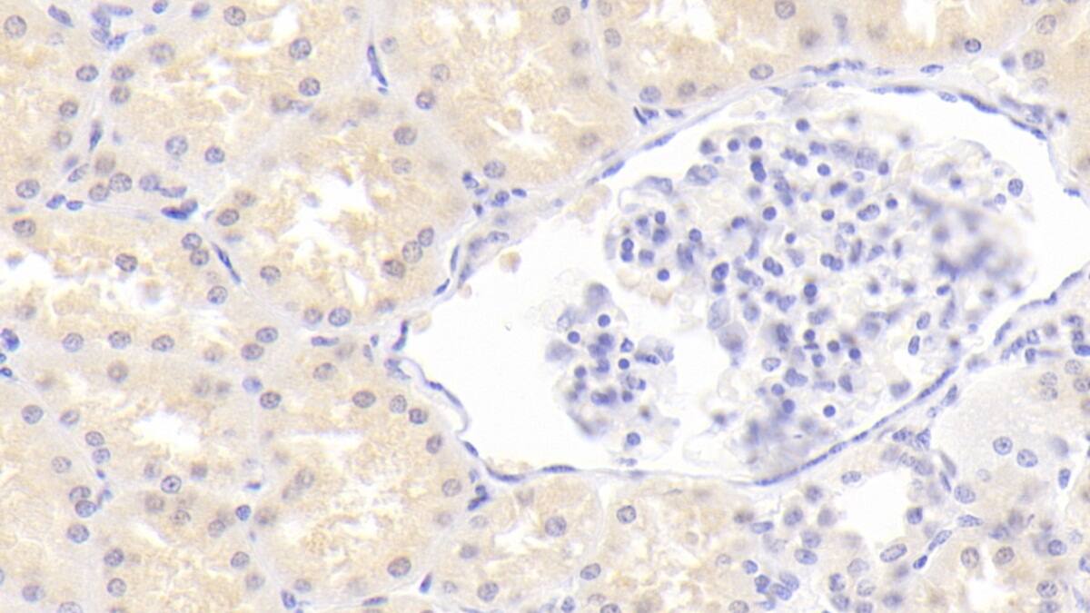 SLC14A1 Antibody (C4)