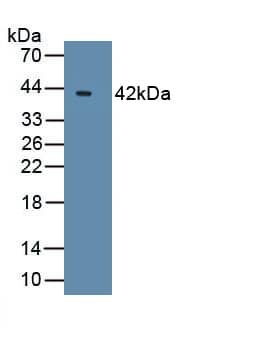 Bcl 7A Antibody