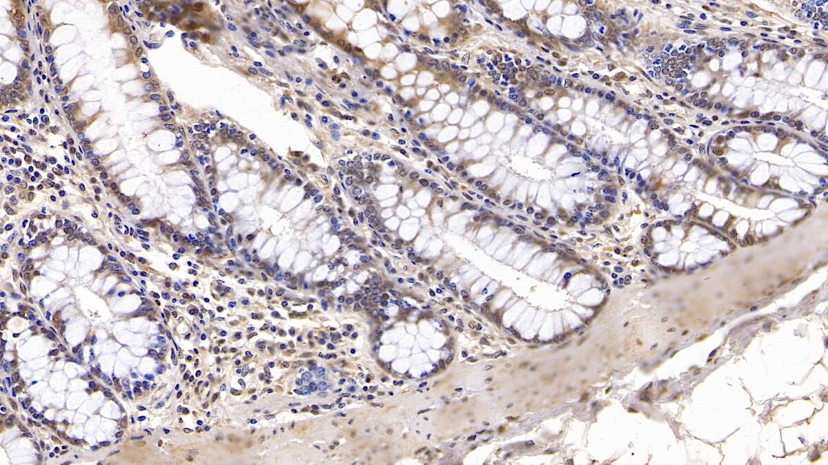 IGFBP-4 Antibody (C7)