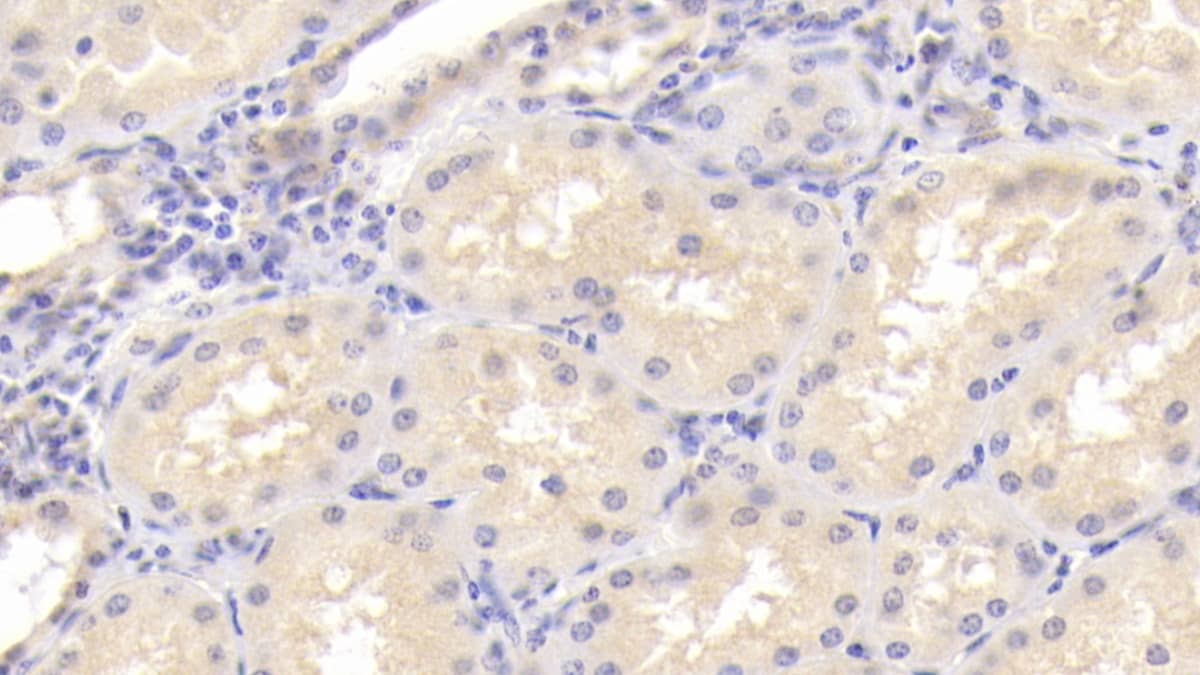 Osteoprotegerin/TNFRSF11B Antibody (C1)