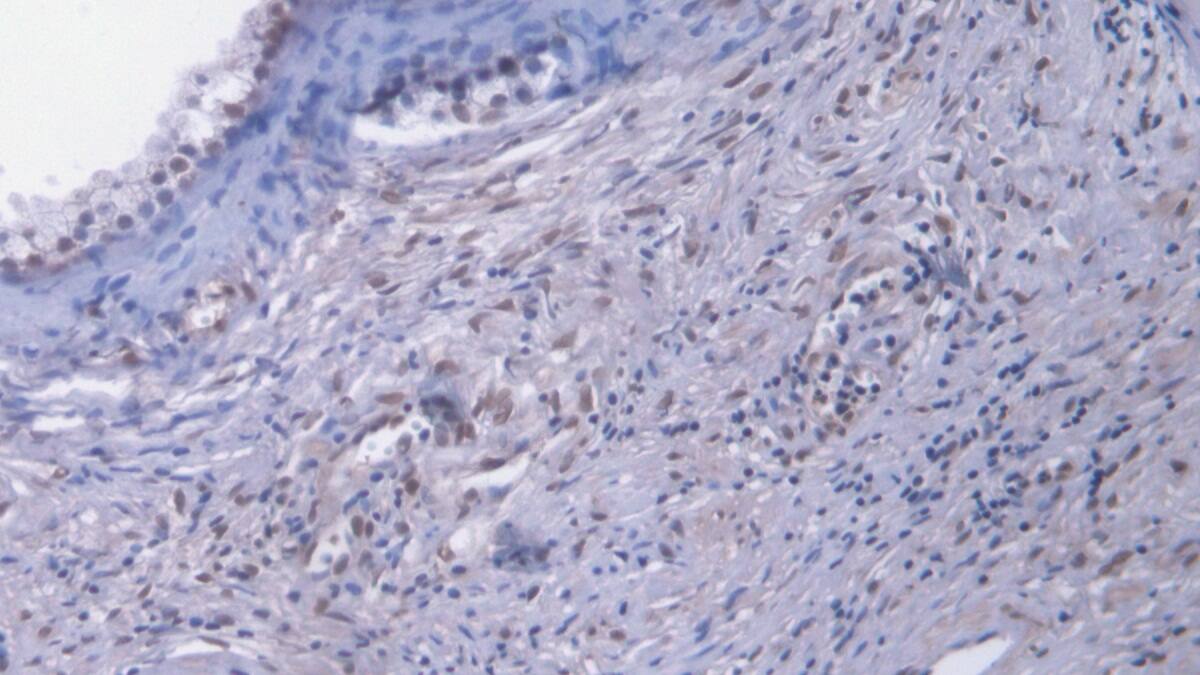 EGR1 Antibody (C15)