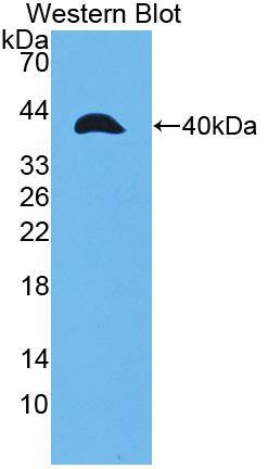 MMP23B Antibody