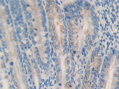 MMP23B Antibody