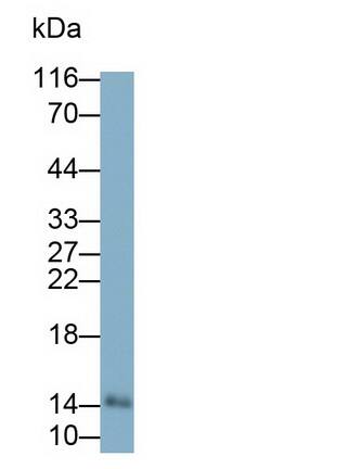 Galectin-7 Antibody (E1)