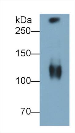 MUC5B Antibody (D7)