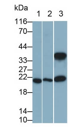 IL-11 Antibody (C2)