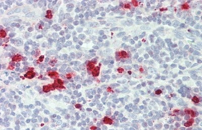 Granzyme M Antibody (D1)