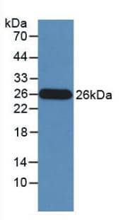 Granzyme M Antibody (D1)