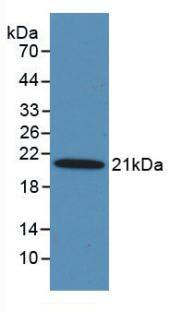 MASP2 Antibody (C3)