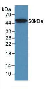 PLA2G7/PAF-AH/Lp-PLA2 Antibody (D6)