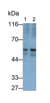 TGF-beta 2 Antibody (F9)