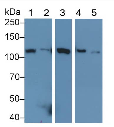 Hexokinase 1 Antibody (C4)