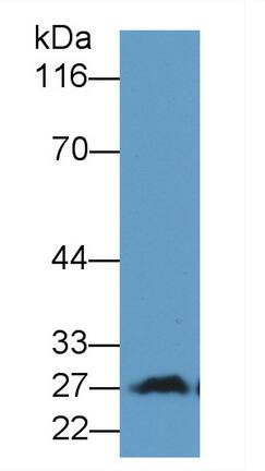 Myelin Protein Zero Antibody (C2)