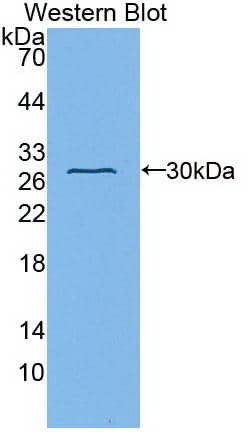 Fibulin 1 Antibody (C6)