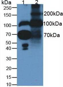 Fibulin 1 Antibody (C6)