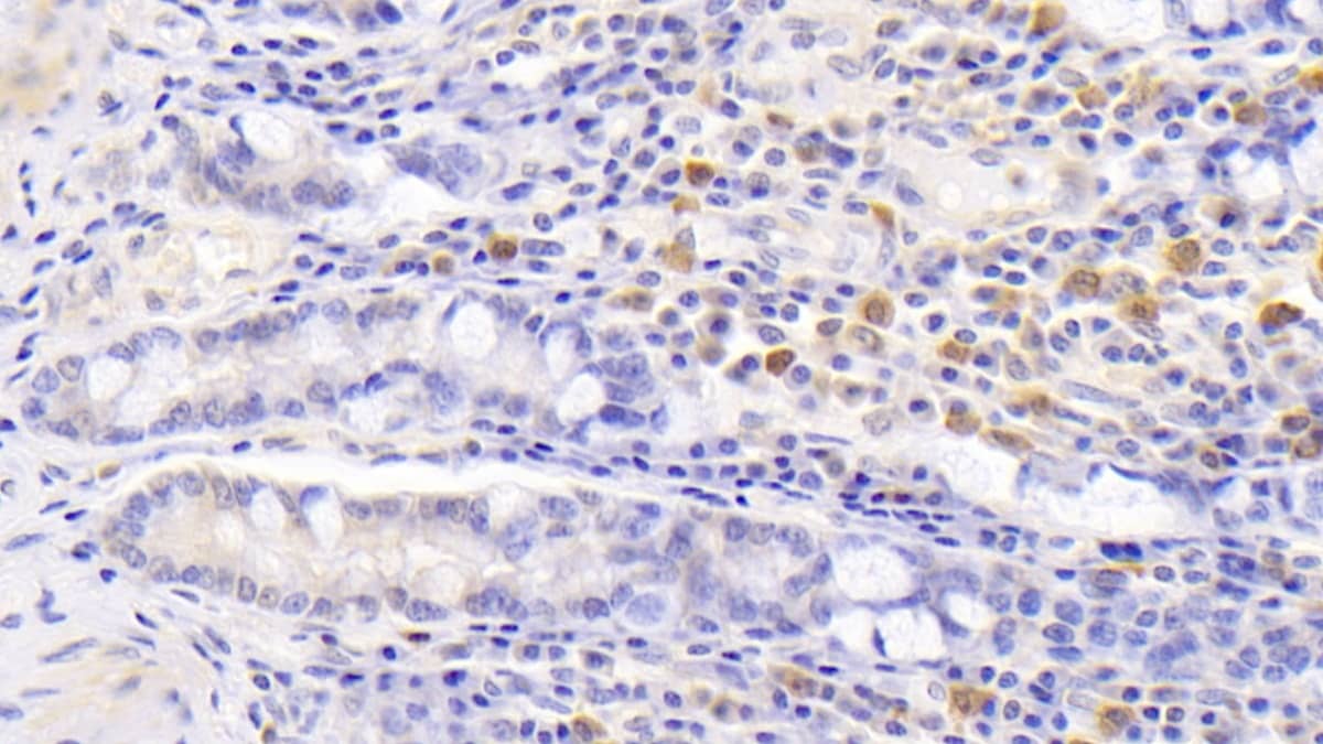 15-Lipoxygenase 1 Antibody (C2)