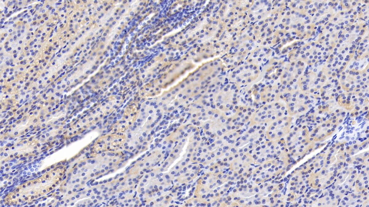 15-Lipoxygenase 1 Antibody (D6)