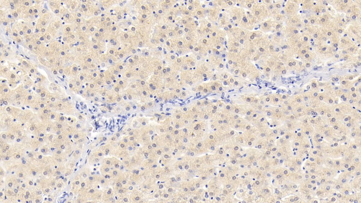 NT-3 Antibody (D1)