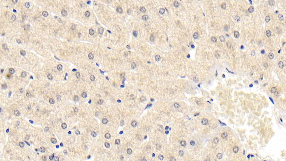 NT-3 Antibody (D3)