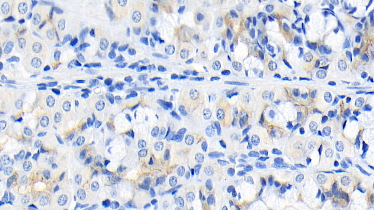 FGF-9 Antibody (E8)