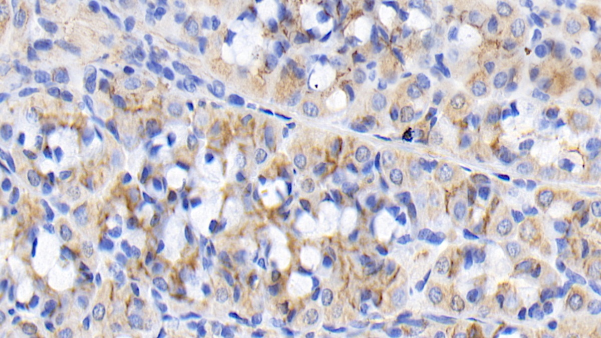 FGF-9 Antibody (E16)