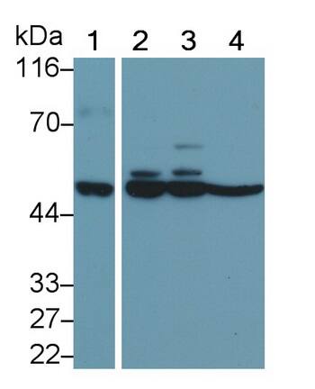 MMP-11 Antibody (D1)