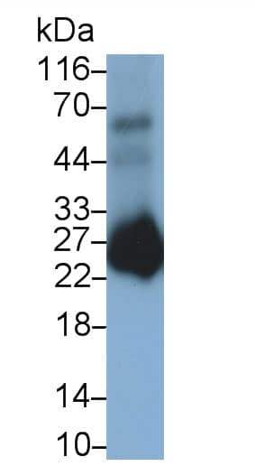 PGD2 Synthase/PTGDS Antibody (C2)