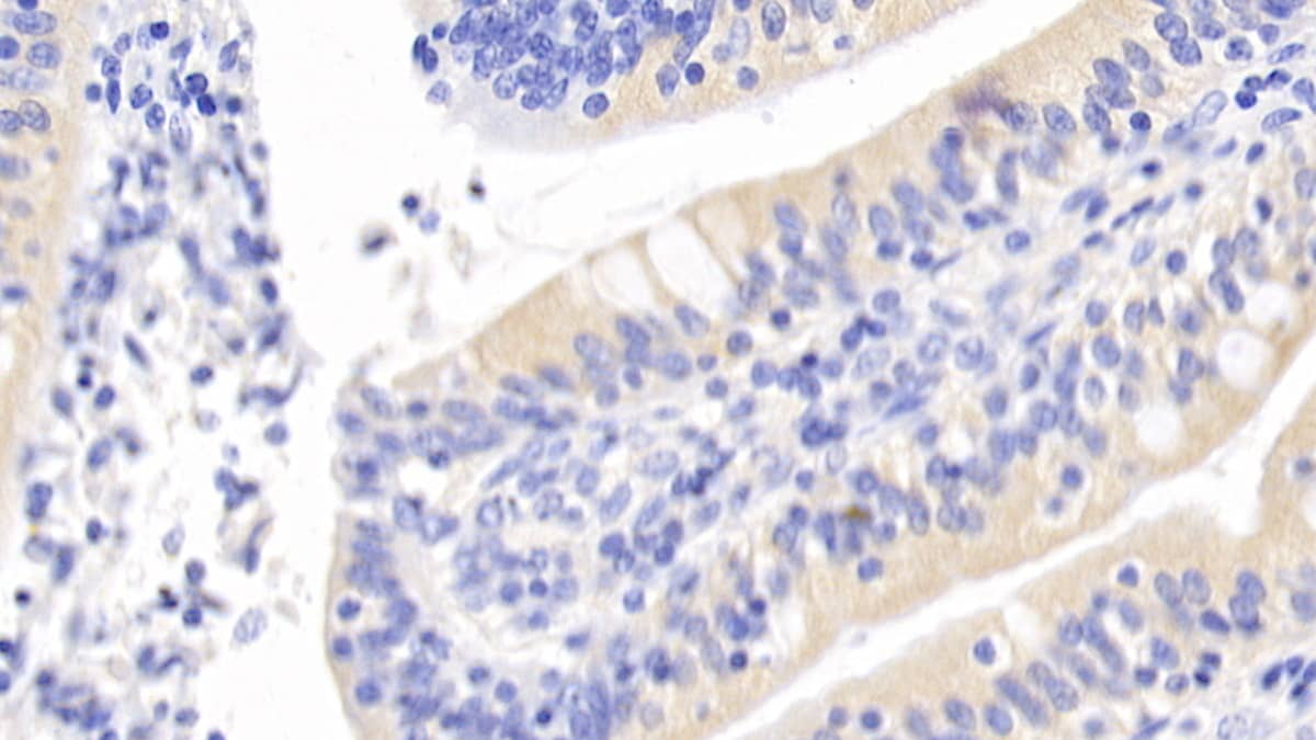 Inhibin beta A Antibody (C3)