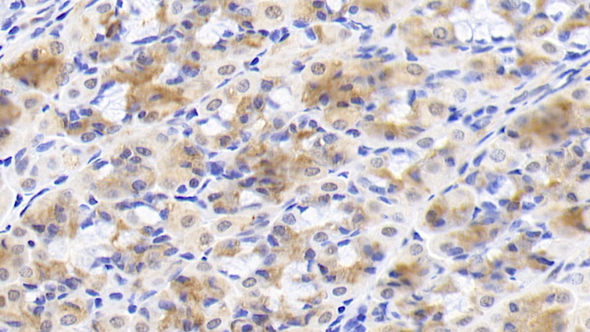 Inhibin beta A Antibody (H9)