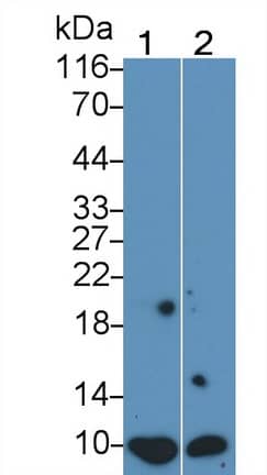 S100A/B Antibody (C5)