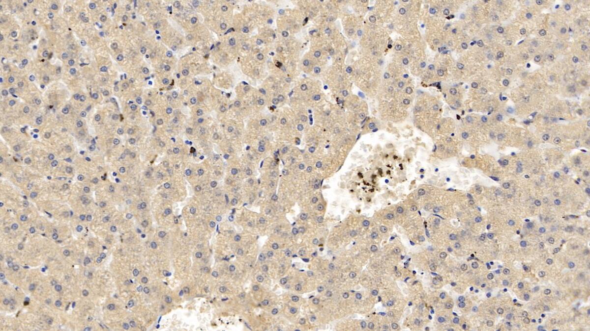 Apolipoprotein C1 Antibody (C14)