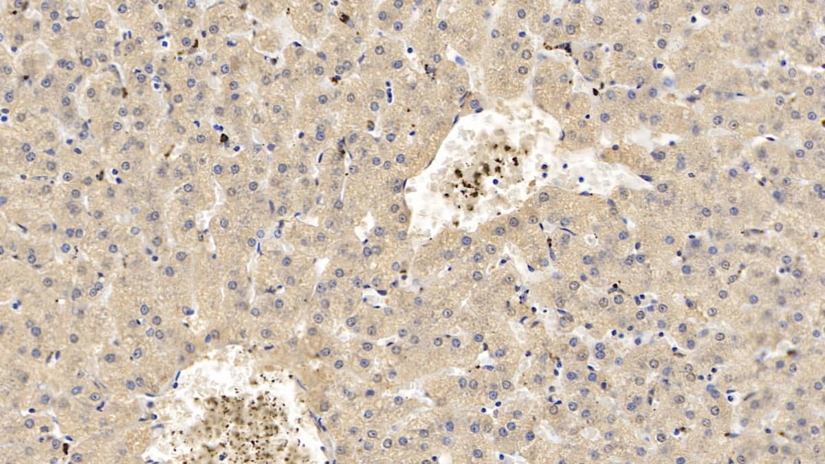 Apolipoprotein C1 Antibody (C14)